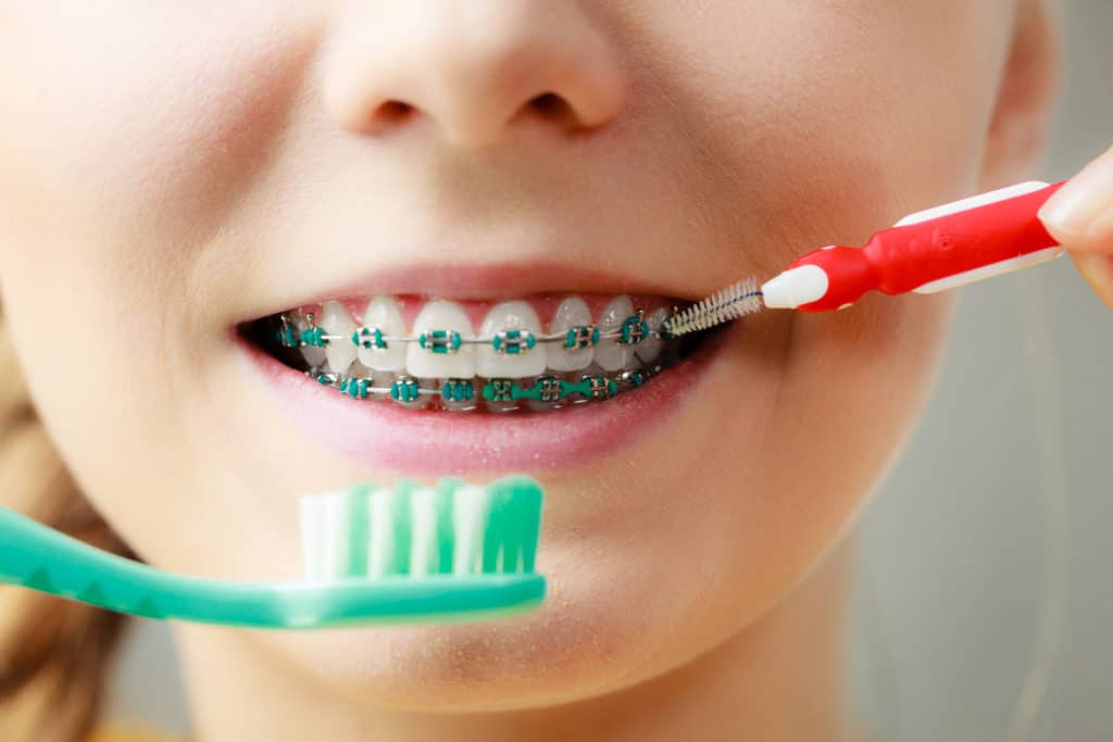 Girl Brushing Teeth with Braces