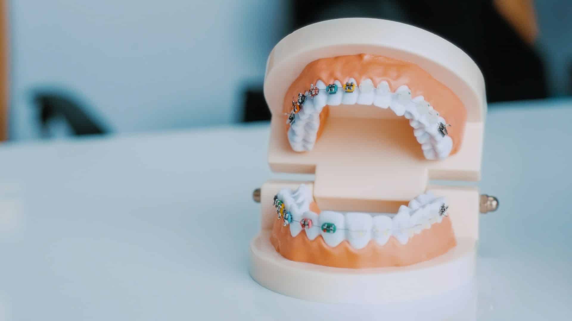 Helpful Fowler Orthodontics Tips & Info 135 Helpful Fowler Orthodontics Tips & Info 8