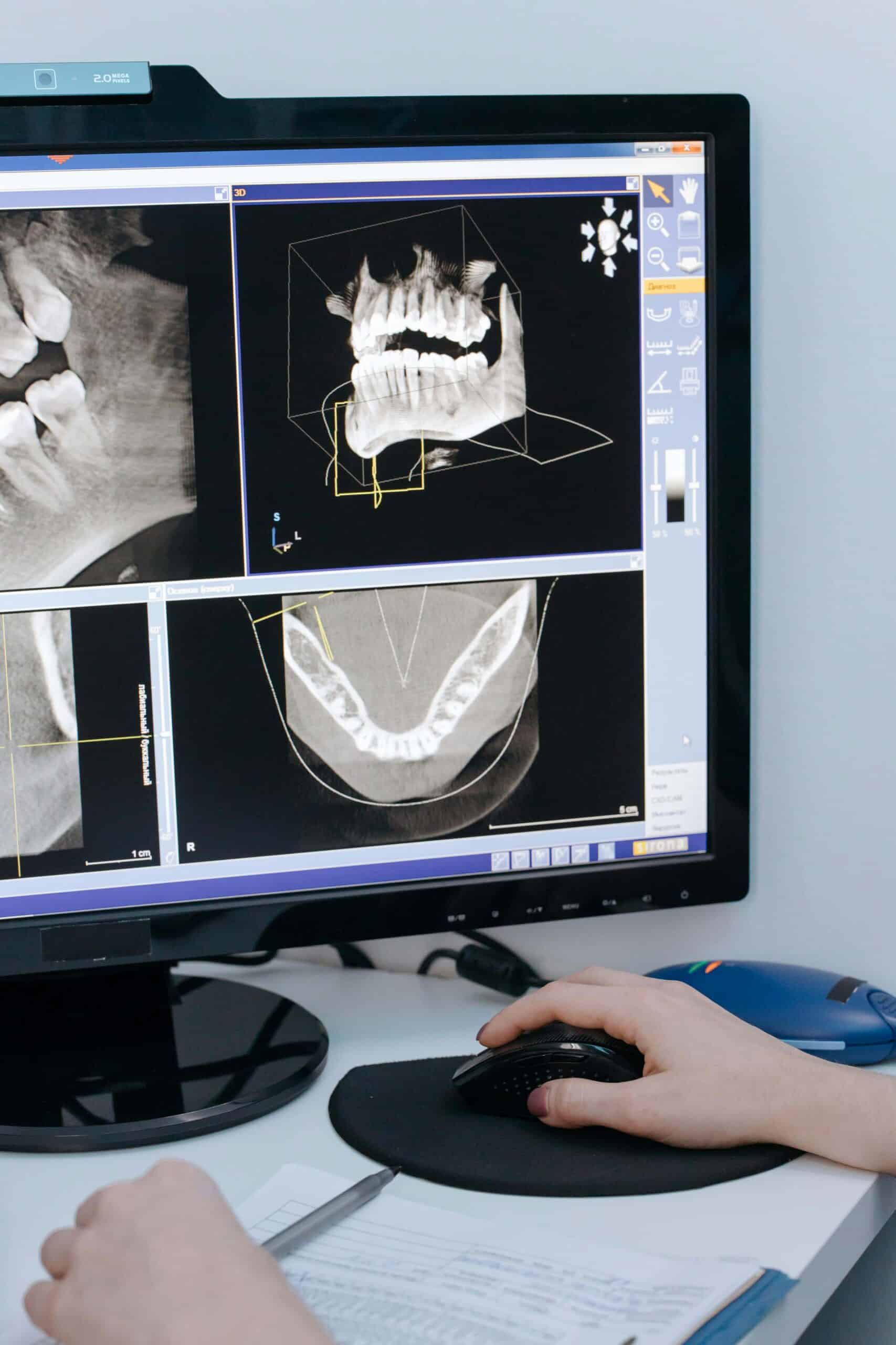 Helpful Fowler Orthodontics Tips & Info 123 orthodontic scan