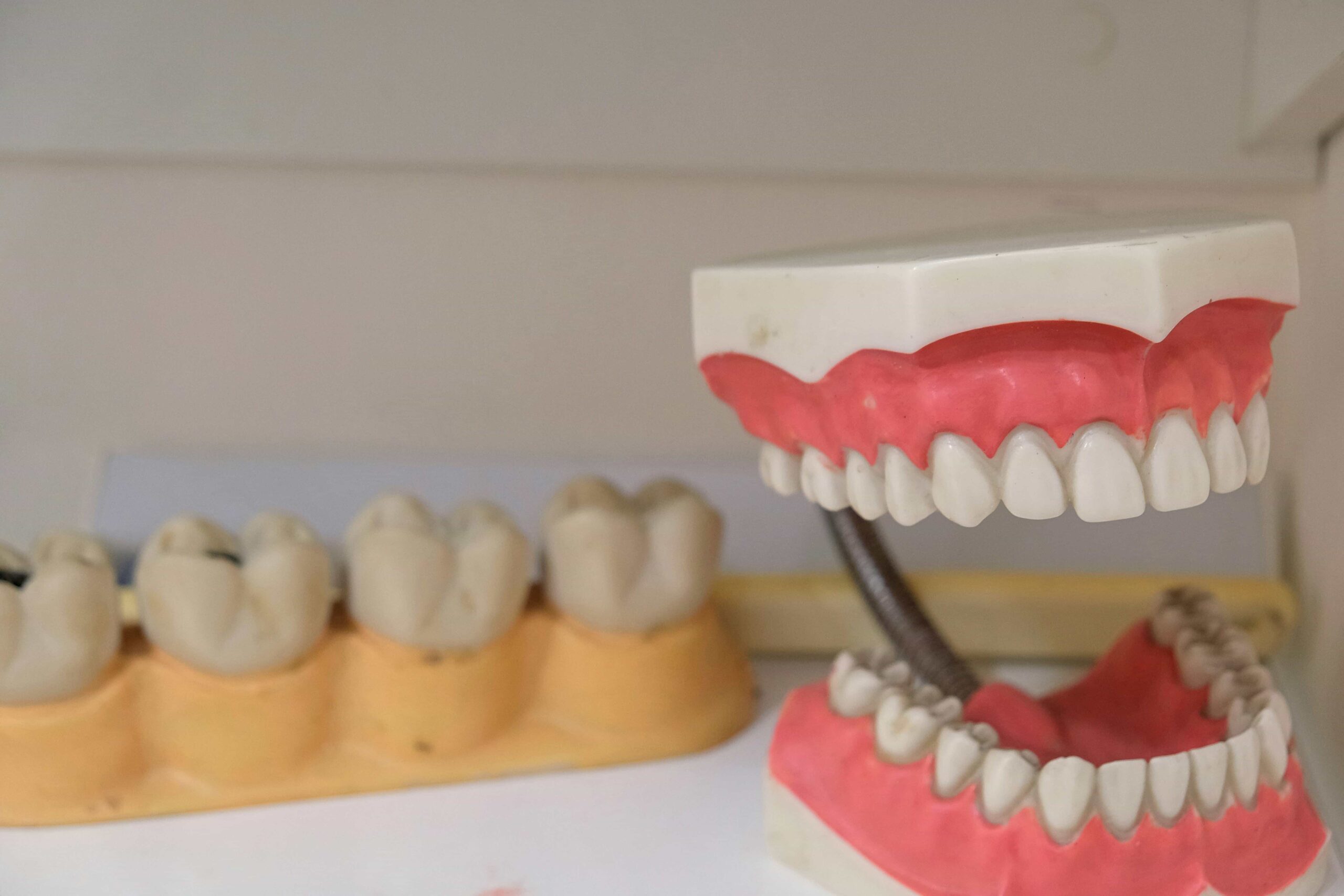 Helpful Fowler Orthodontics Tips & Info 109 tooth and mouth model