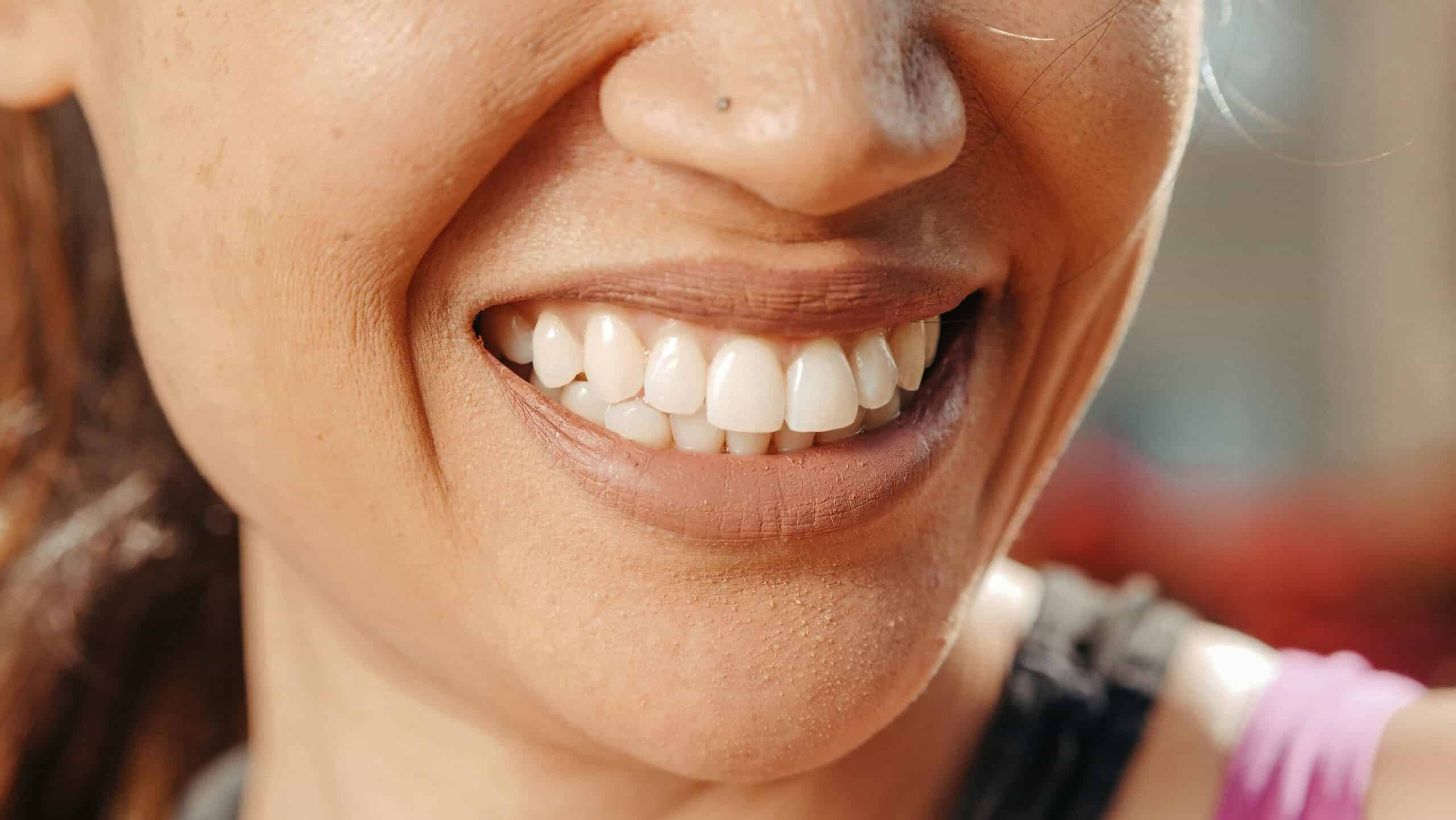 Helpful Fowler Orthodontics Tips & Info 105 straight teeth